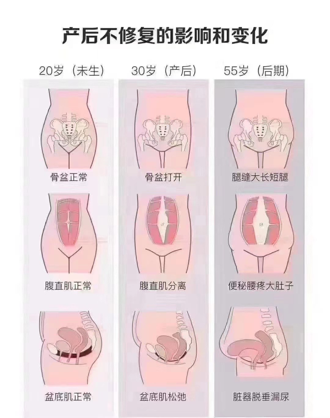 腹白线图片怀孕图片