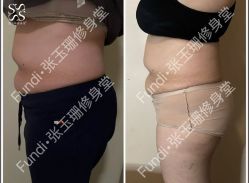 -Fundi张玉珊修身堂·indiba·BTL科技瘦身