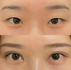 -素美医疗美容·西南眼鼻整形·修复基地