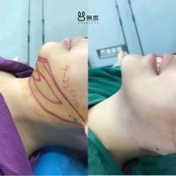 -上海漾颜医疗美容