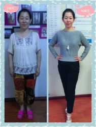 -维纳斯专业减肥