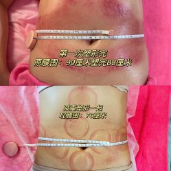 -良咔瘦身·减脂塑形