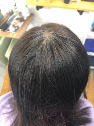 -髻尚坊增发补发织发假发定制