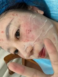 体验后-苏州卫康美容医院