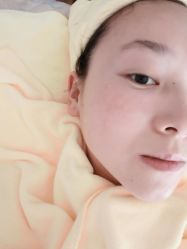 -苗方清颜专业祛痘连锁机构