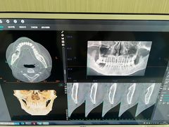 -同步齿科·数字化正畸种植口腔中心(珠海店)