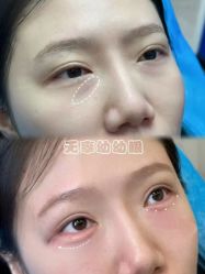 点击看大图 -Yestar艺星医疗美容医院