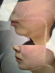 点击看大图 -杭州米兰柏羽医疗美容医院