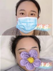 -久匠·纹眉纹绣半永久