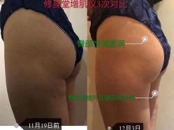 -Fundi张玉珊修身堂·indiba·BTL科技瘦身