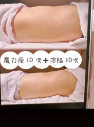 -Lily纤美·科技减脂中心
