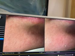 -苑苑vbeauty科技美容SPA