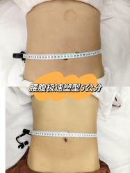 -Lily纤美·科技减脂中心