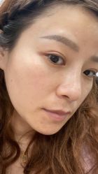 体验前-上海玫瑰医疗美容医院