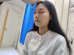 -欧扬医疗美容