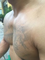 -天道专业洗纹身