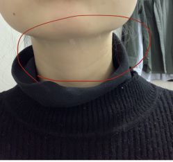 -慕颜医疗美容·皮肤微整 抗衰