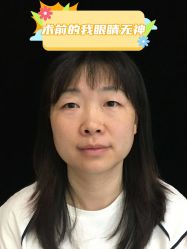 -素美医疗美容·西南眼鼻整形·修复基地