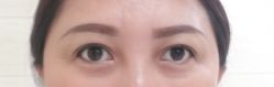 -天津健丽·去眼袋医疗美容机构