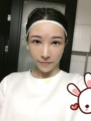 点击看大图 -大麦微针植发丨全国连锁