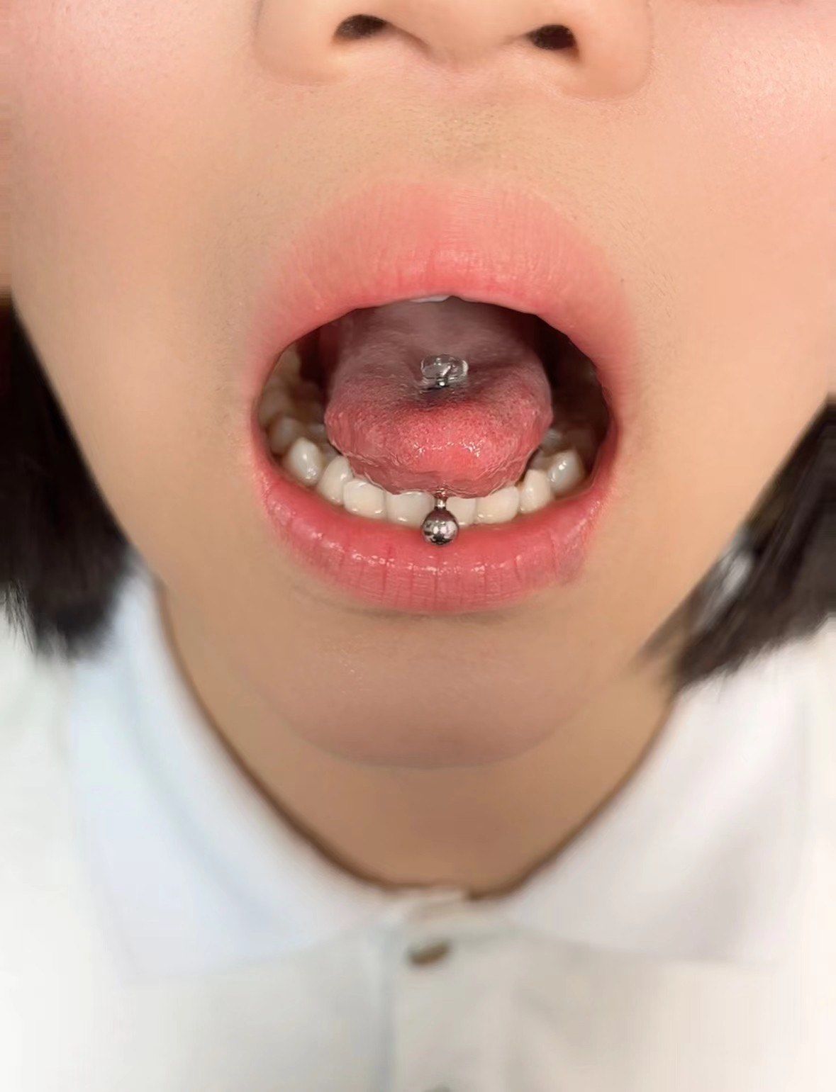 伟德国际舌钉护理推荐ppt