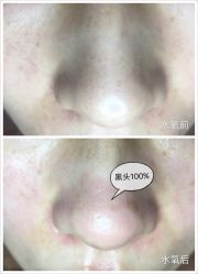 水氧-光SPA科技美肤