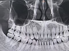 -深圳富茂格伦菲尔口腔门诊部(龙华清湖总院)