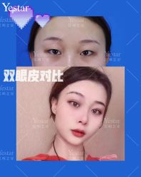 -Yestar艺星医疗美容医院
