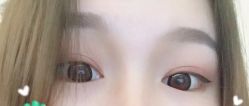 -天津健丽·去眼袋医疗美容机构
