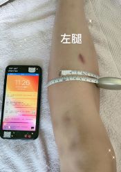 -Lily纤美·科技减脂中心