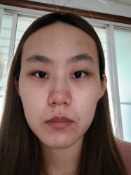 体验后-序言科技美肤中心