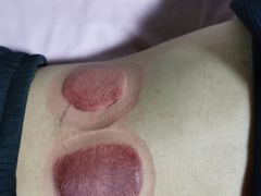 -沈师傅盲人按摩工作室(密三小区店)