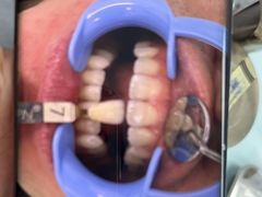 -同步齿科·同富门诊·正畸种植口腔旗舰店(布吉店)