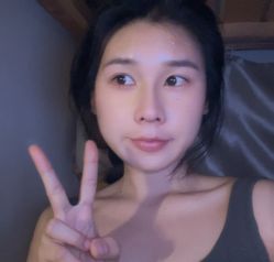 体验后-上海首尔丽格医疗美容医院