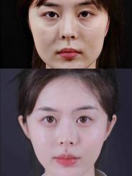 -Yestar 嘉兴艺星医疗美容医院