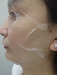 -长沙雅美医疗美容医院
