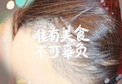 -大麦微针植发全国连锁