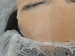 -长沙雅美医疗美容医院