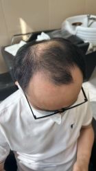 -唐风采假发补发定制