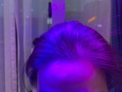 -雍禾植发全国连锁