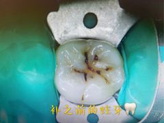 -深圳佑诺口腔门诊部