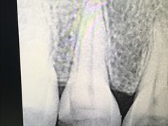 -武汉大学人民医院(首义院区)