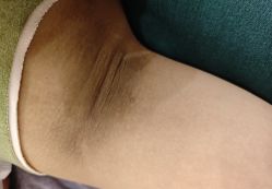 -清疣美疣·痣·斑净肤中心