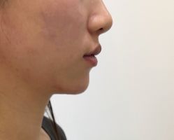 -Yestar 嘉兴艺星医疗美容医院