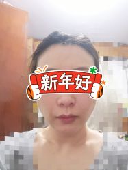 体验后-联合丽格·张菡丽格医疗美容