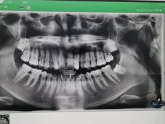 -深圳富茂格伦菲尔口腔门诊部(龙华清湖总院)