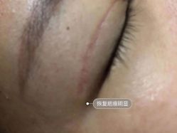 -深圳阳光医疗美容医院·旗舰店