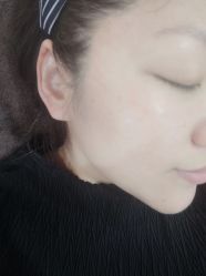 体验前-洁铭新加坡医美