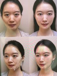 -东莞壹加壹整形美容医院