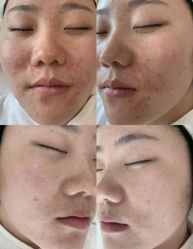 -Cream88颜皮肤管理中心